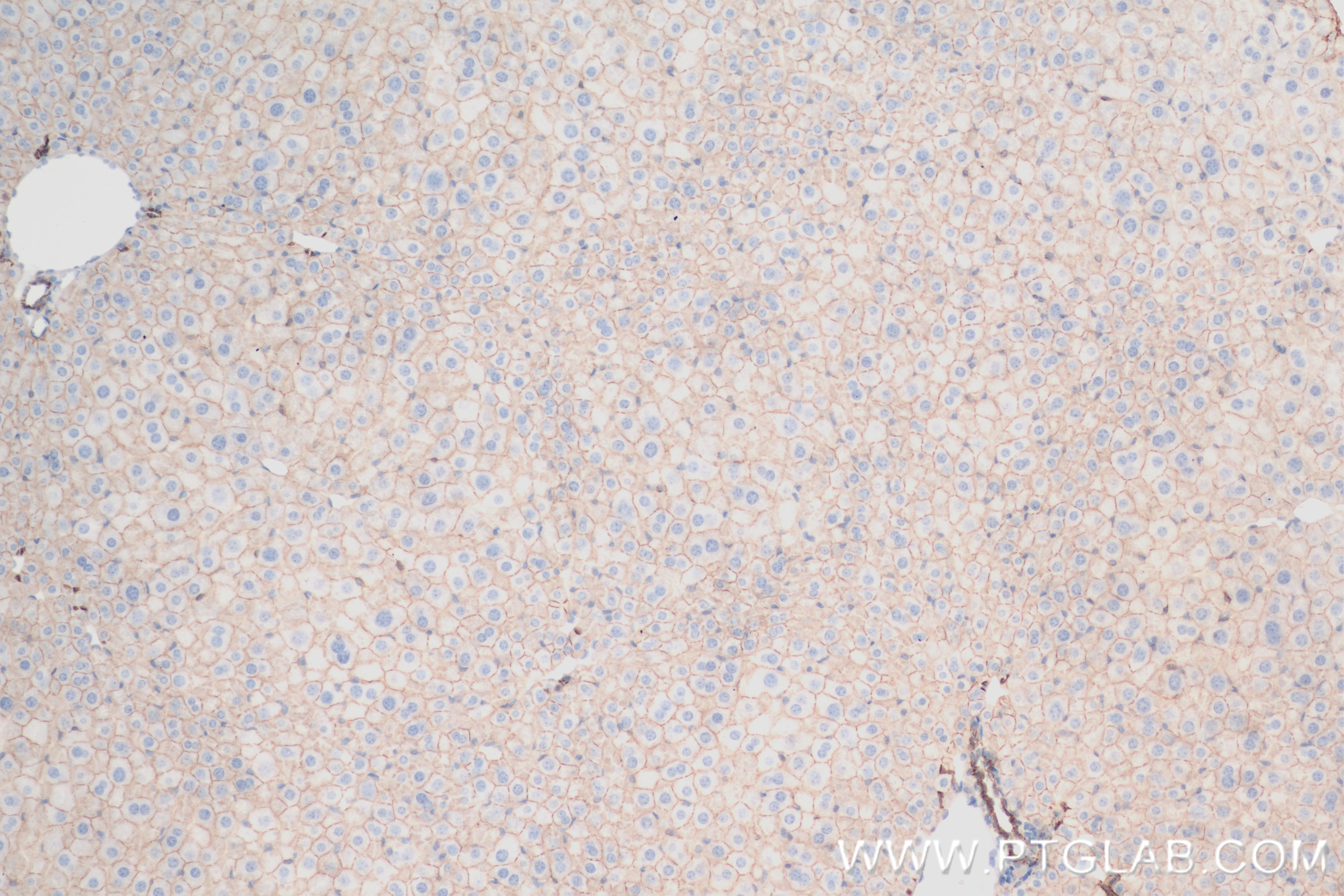 IHC staining of mouse liver using 84528-1-RR