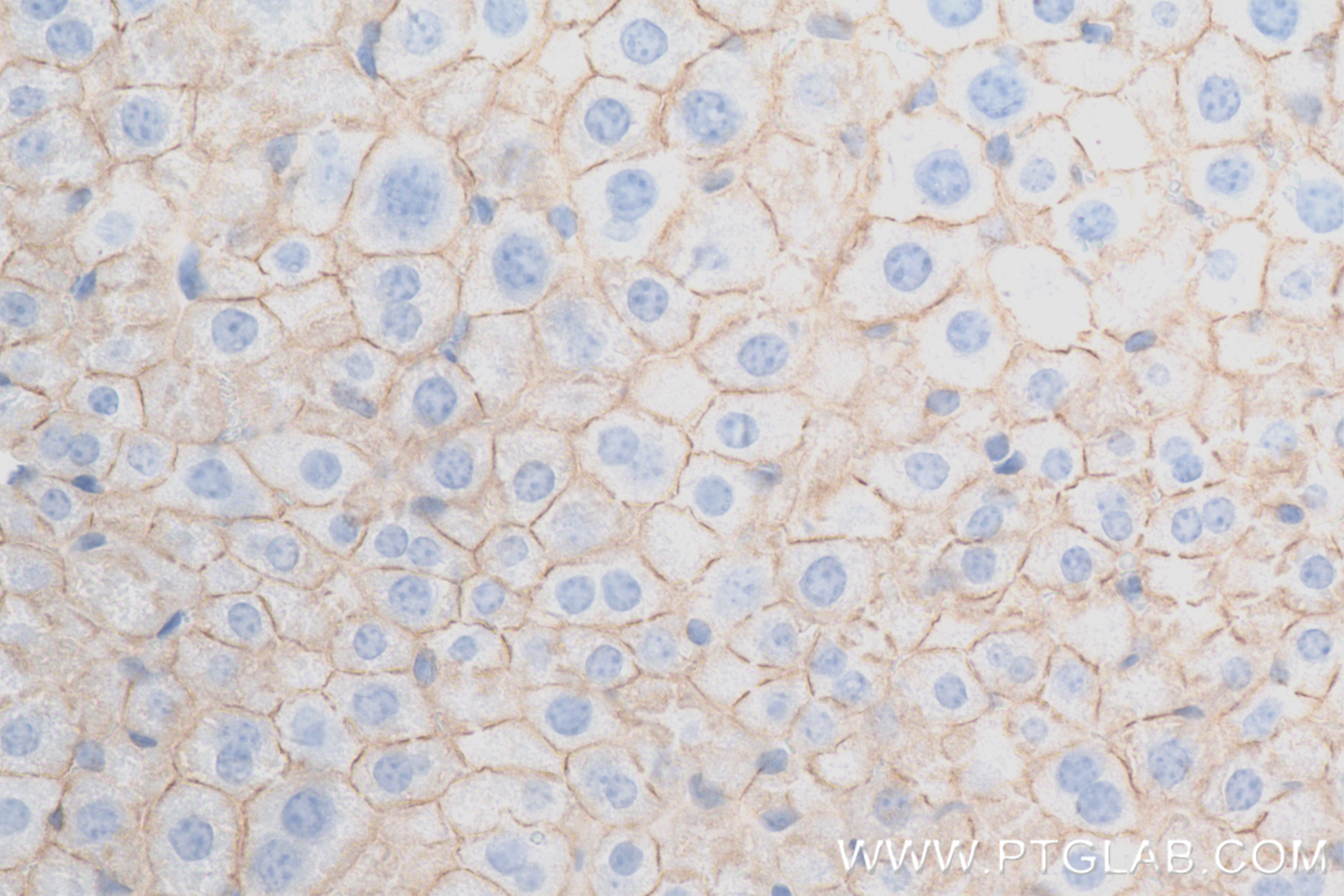 IHC staining of mouse liver using 84528-1-RR (same clone as 84528-1-PBS)