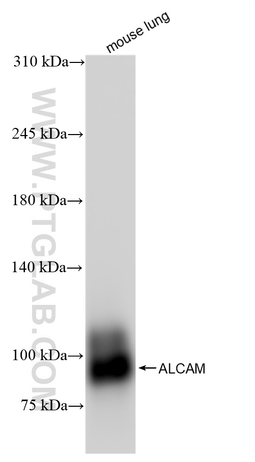 WB analysis of mouse lung using 84528-1-RR