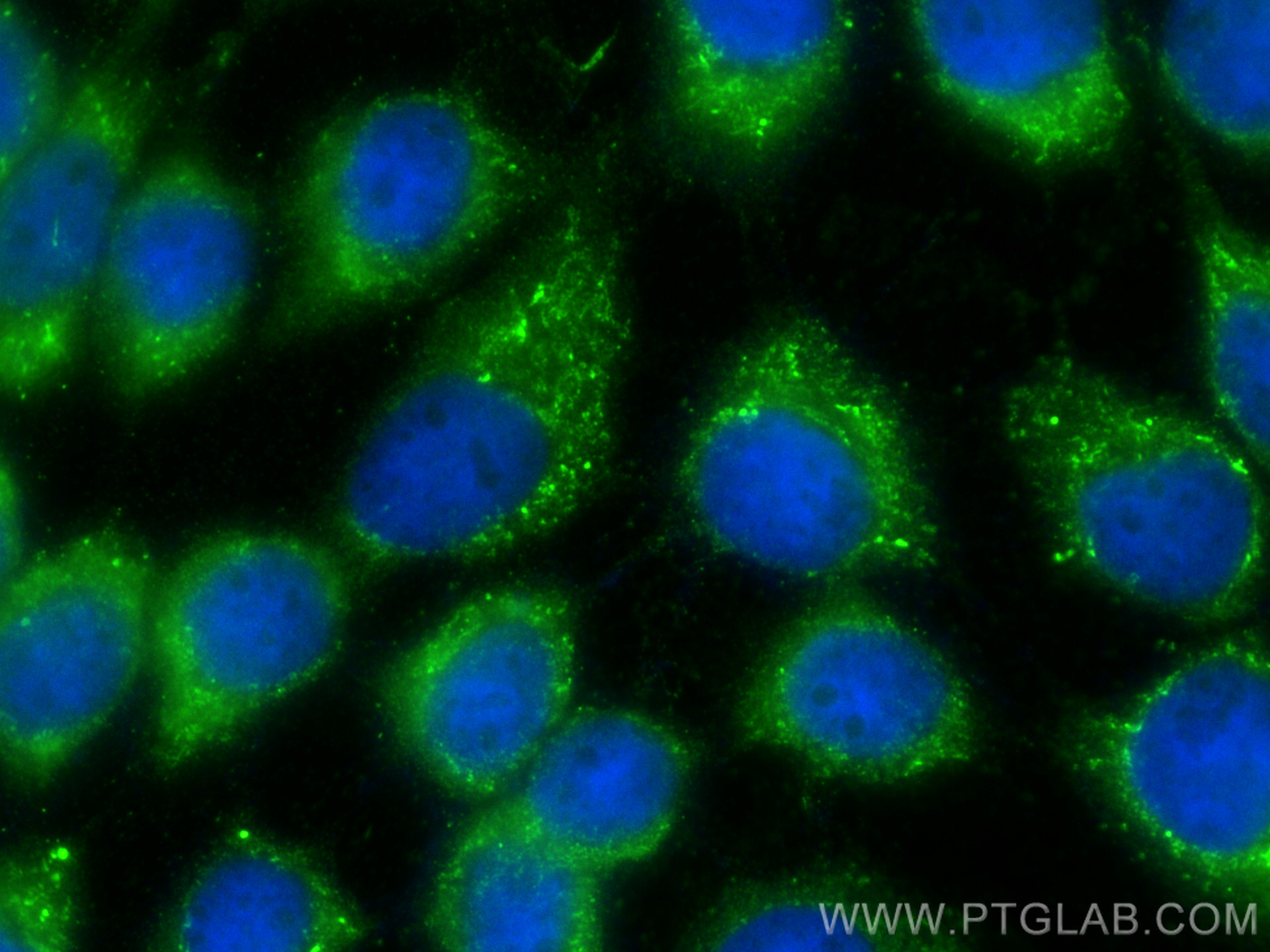 IF Staining of A431 using 17719-1-AP