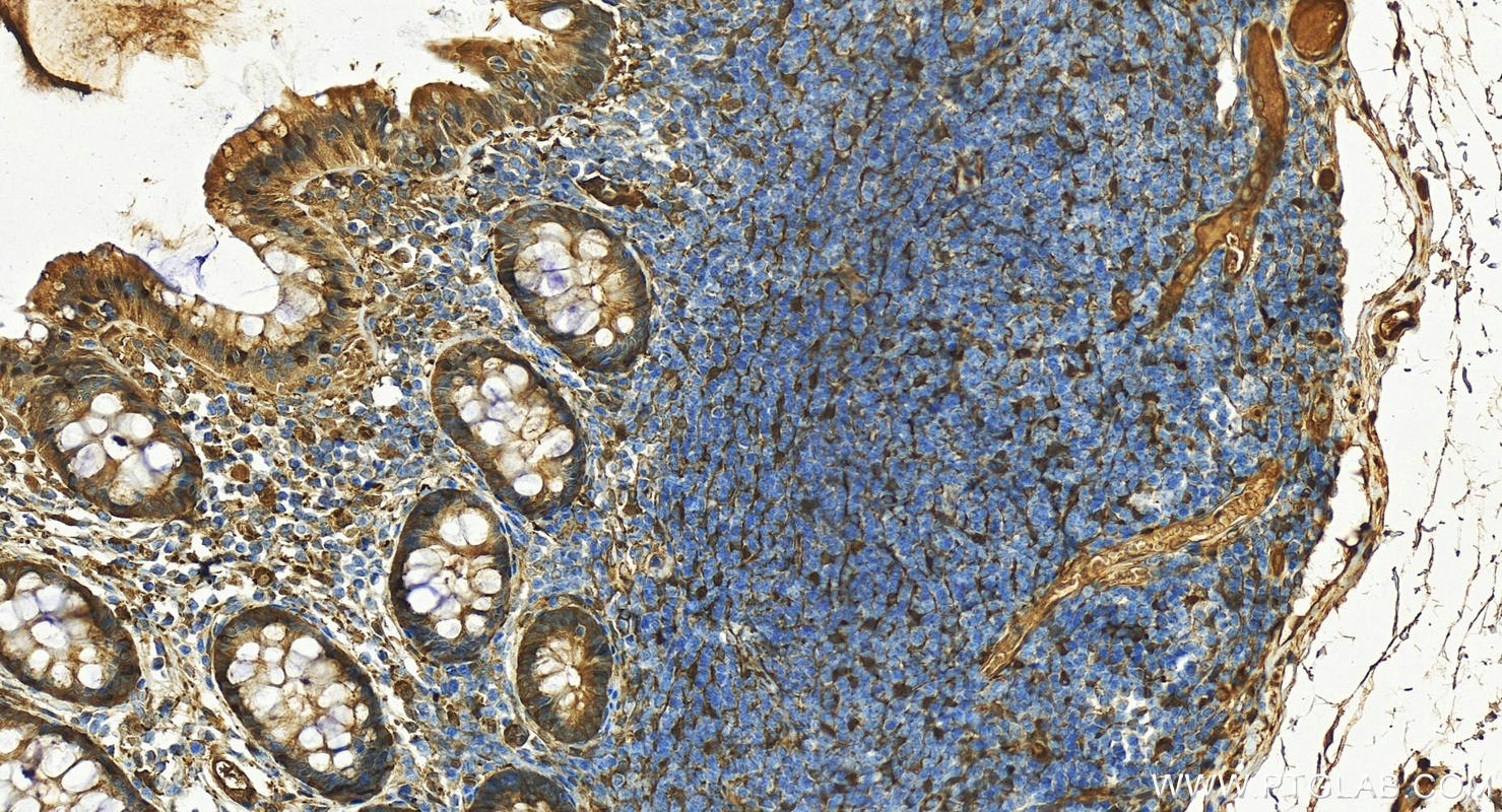 IHC staining of human colon using 15910-1-AP