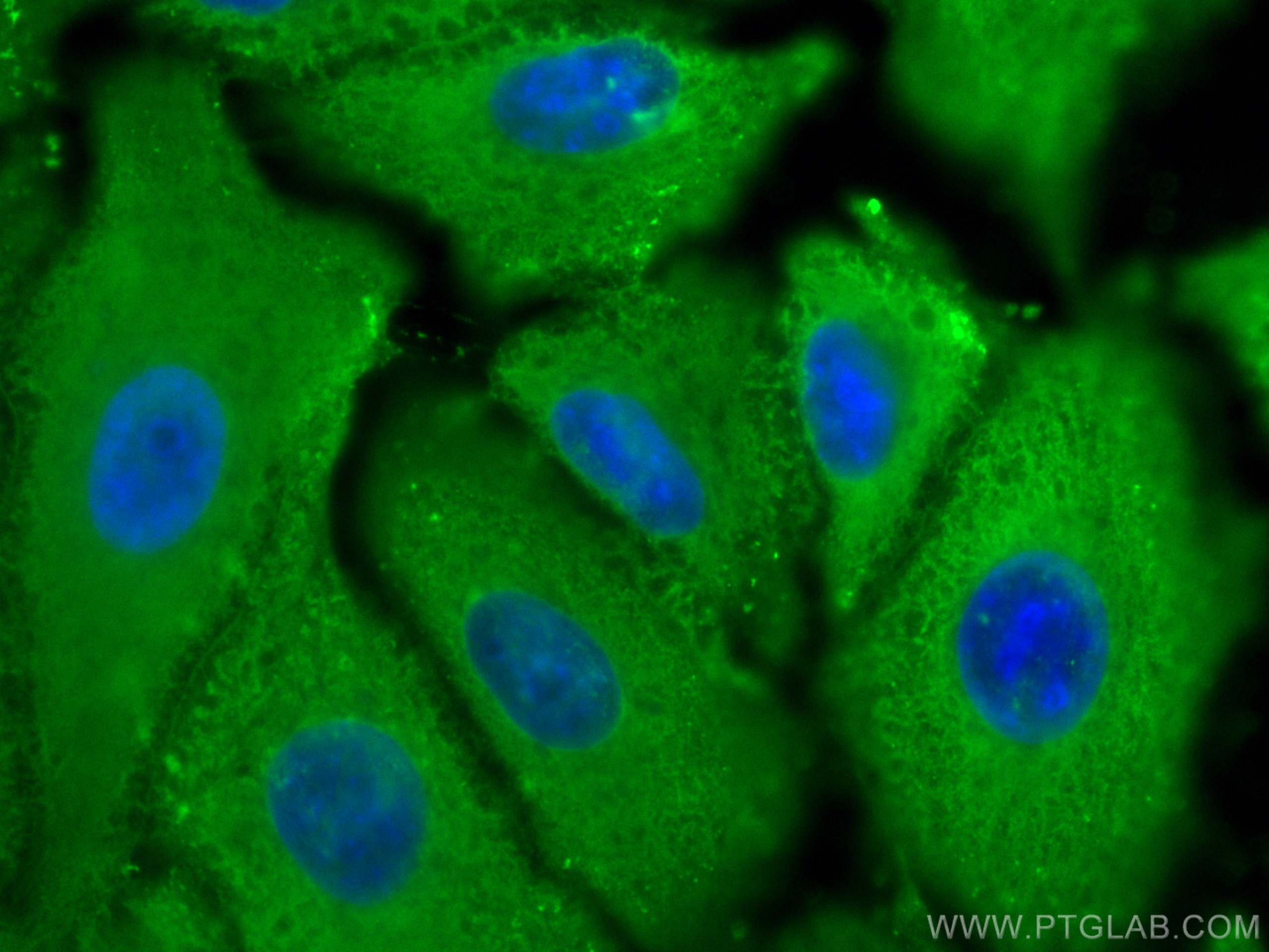 IF Staining of A549 using 15910-1-AP