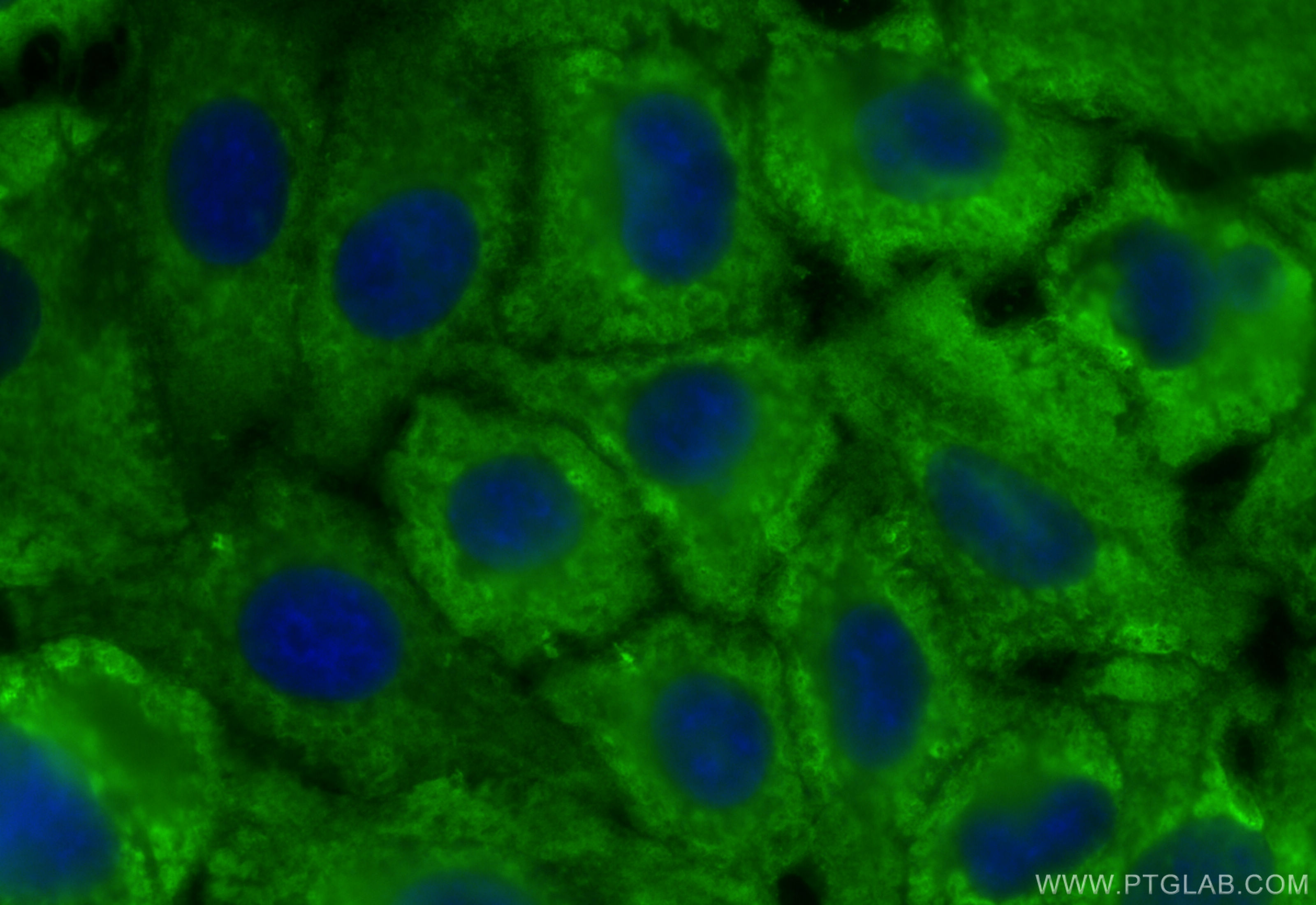 IF Staining of A549 using 15910-1-AP