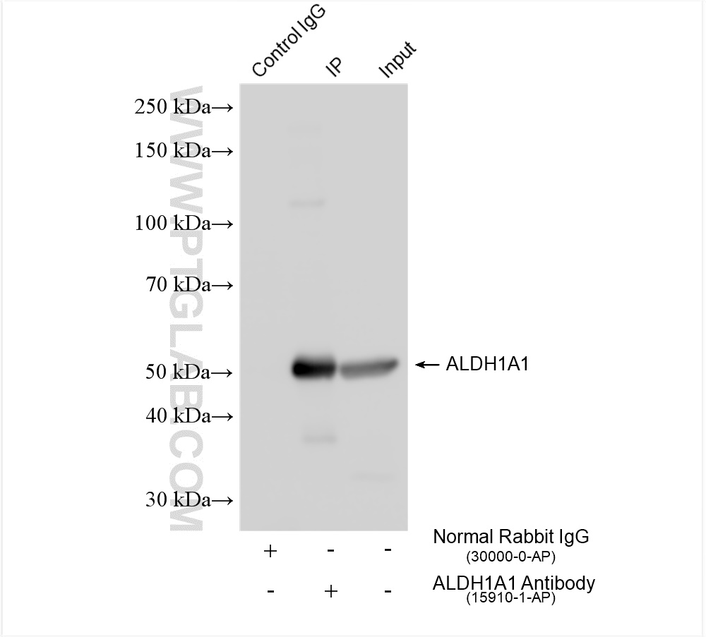 IP experiment of mouse liver using 15910-1-AP