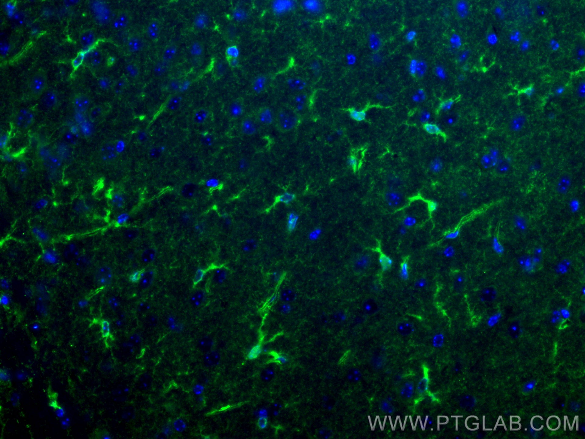 IF Staining of mouse brain using CL488-17390