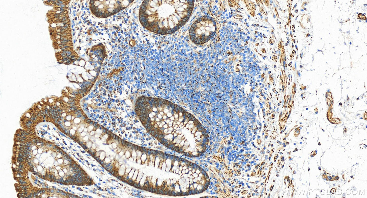 IHC staining of human normal colon using 15310-1-AP