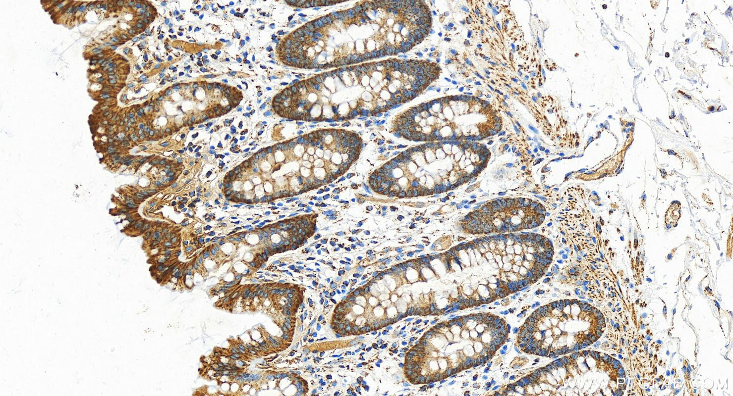 IHC staining of human normal colon using 15310-1-AP