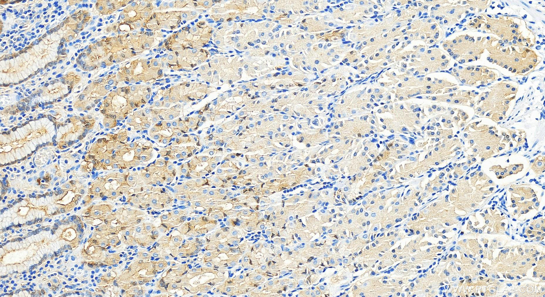 IHC staining of human stomach using 15578-1-AP