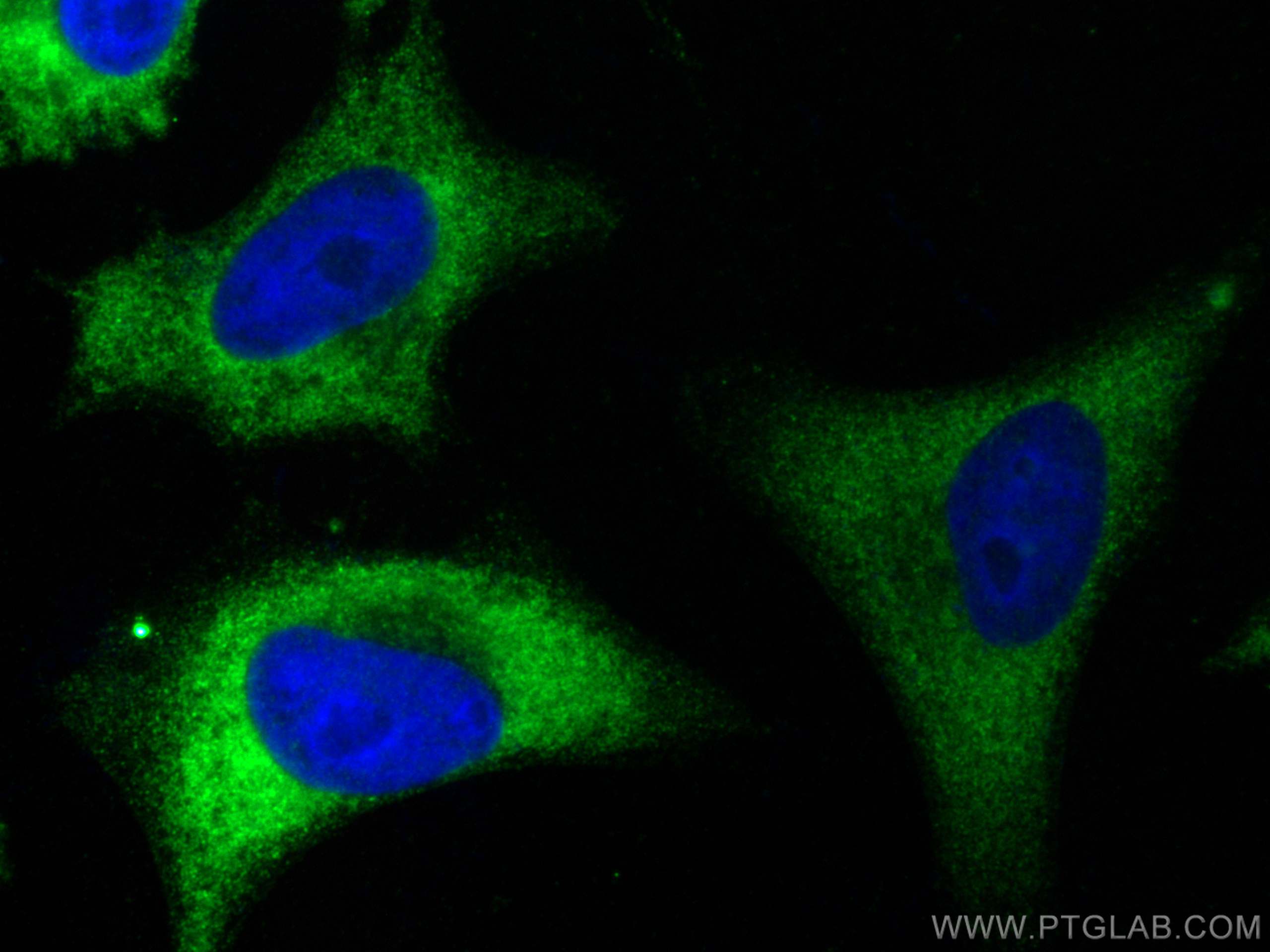 IF Staining of HeLa using 26621-1-AP