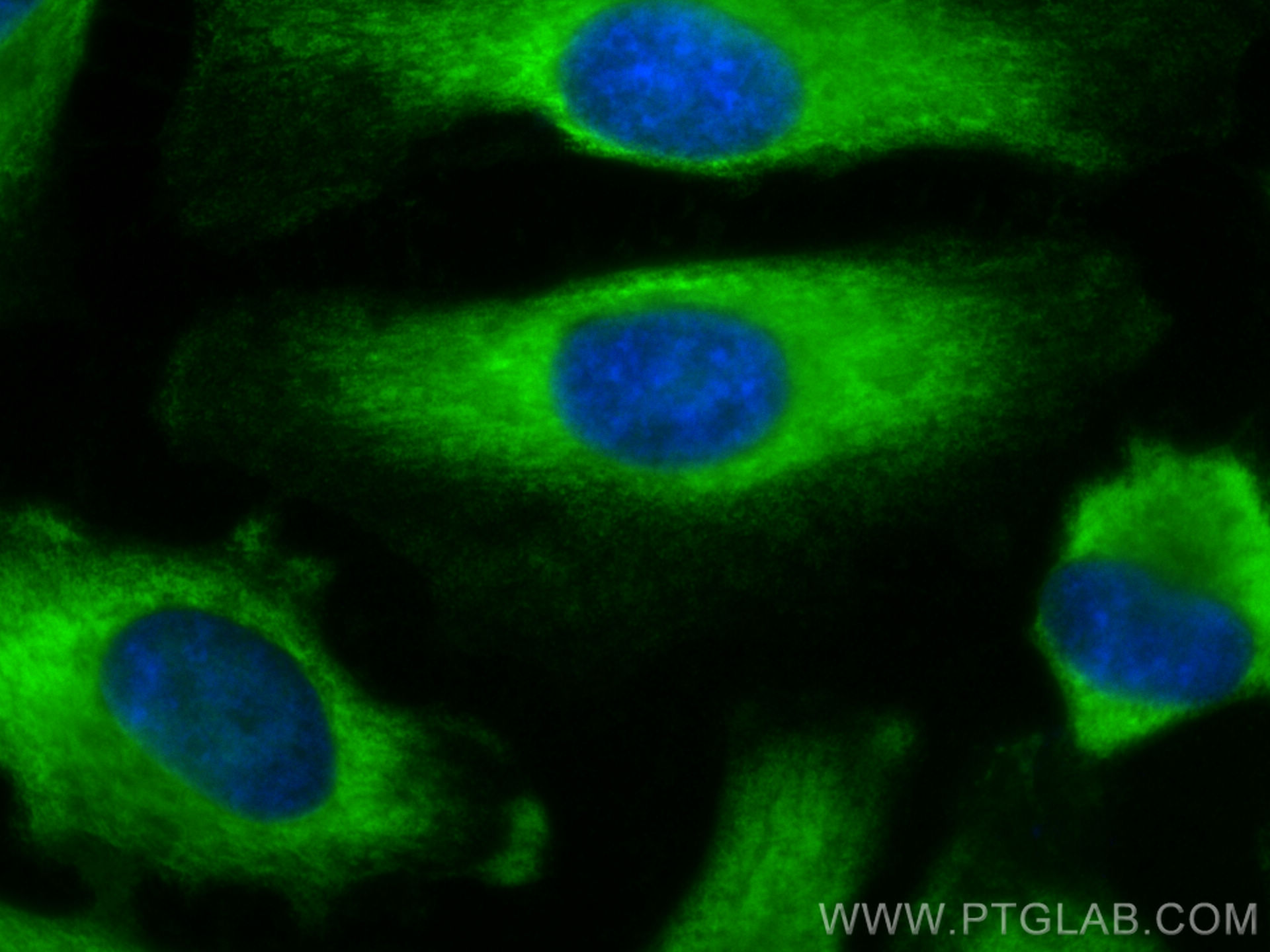 IF Staining of HeLa using 11217-1-AP