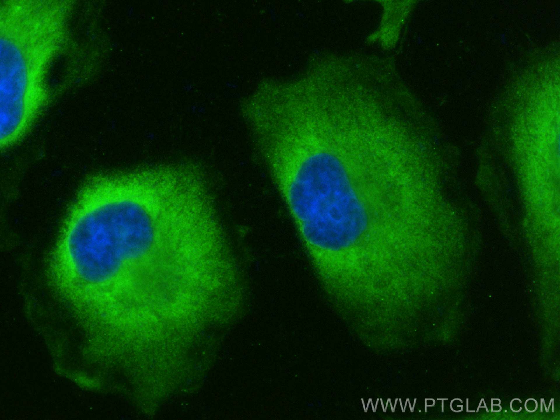 IF Staining of HeLa using 67453-1-Ig