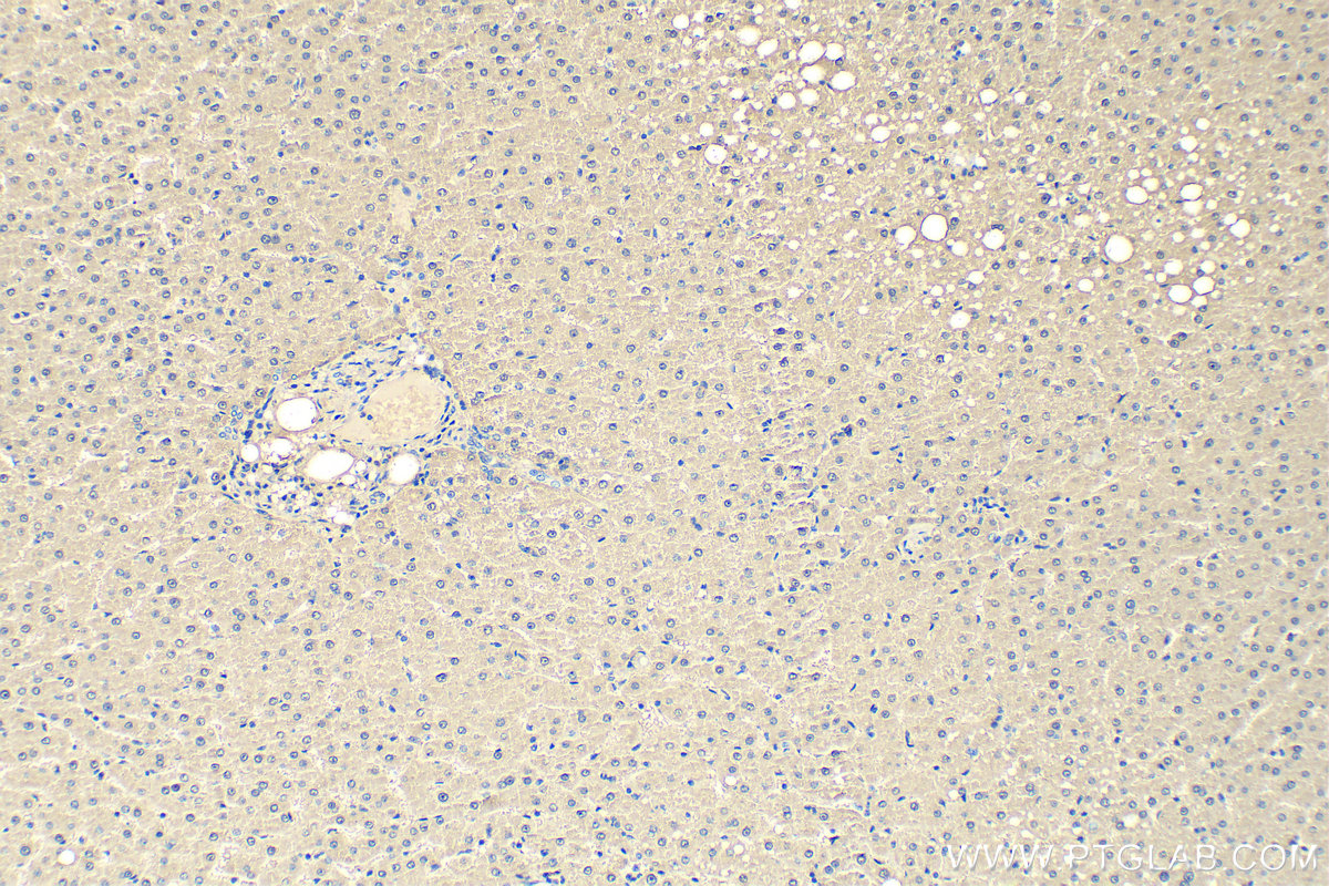 IHC staining of human liver using 18065-1-AP