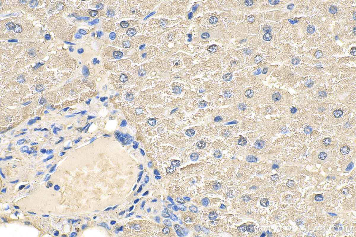 IHC staining of human liver using 18065-1-AP