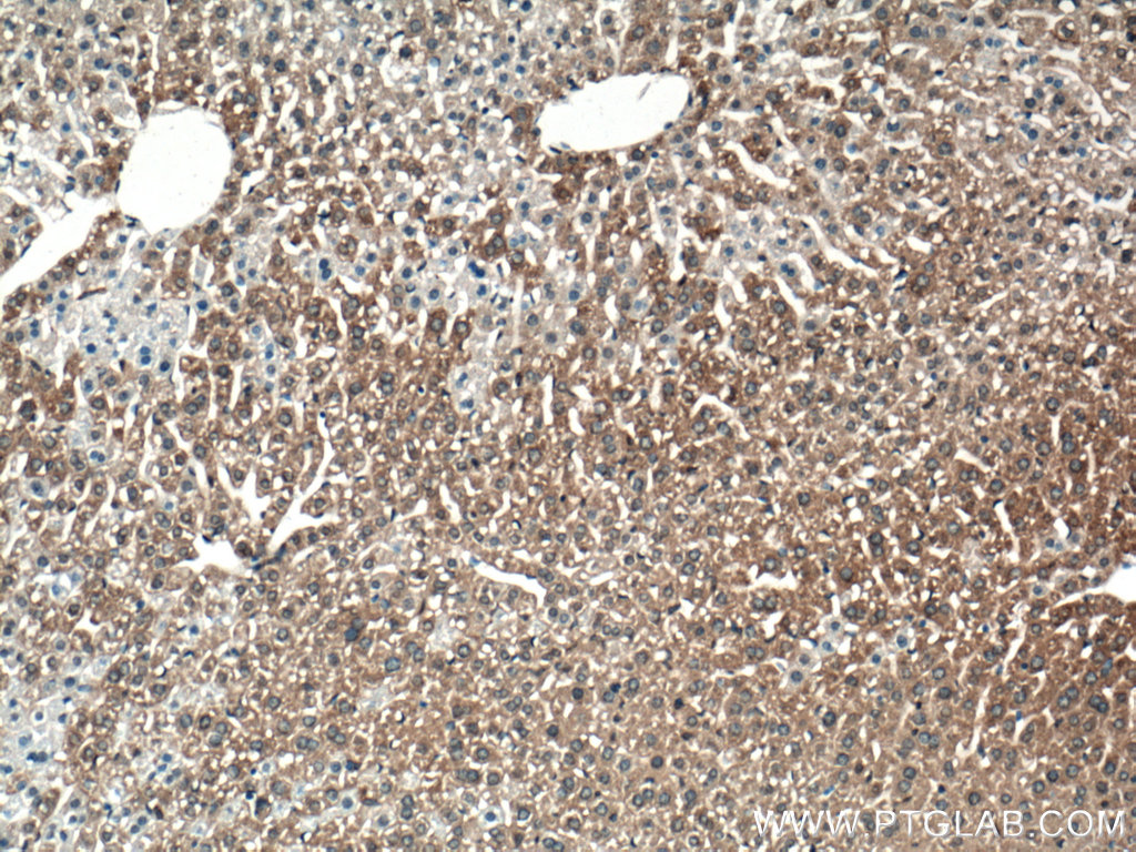 IHC staining of mouse liver using 16046-1-AP