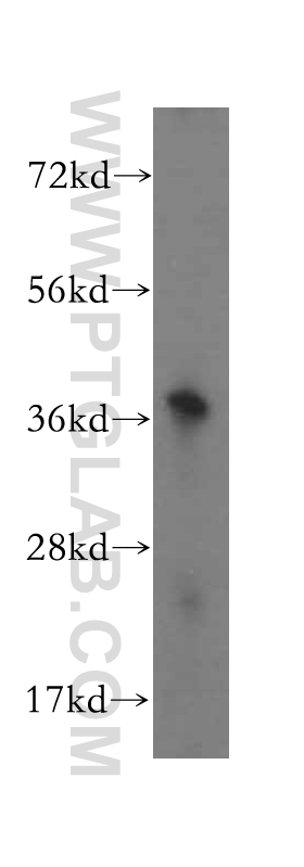 WB analysis of human kidney using 16046-1-AP