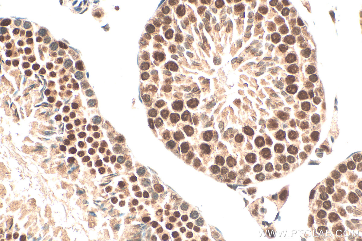 IHC staining of mouse testis using 16837-1-AP