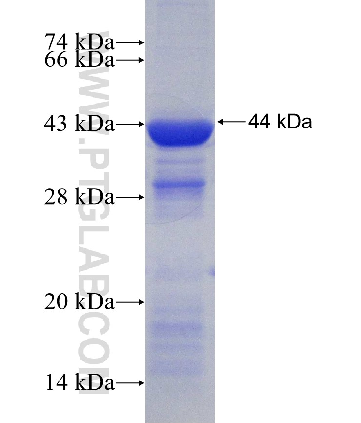 ALOX15B fusion protein Ag30796 SDS-PAGE