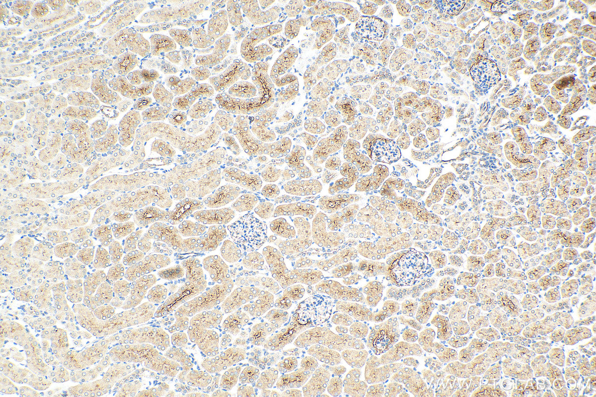 IHC staining of mouse kidney using 11187-1-AP