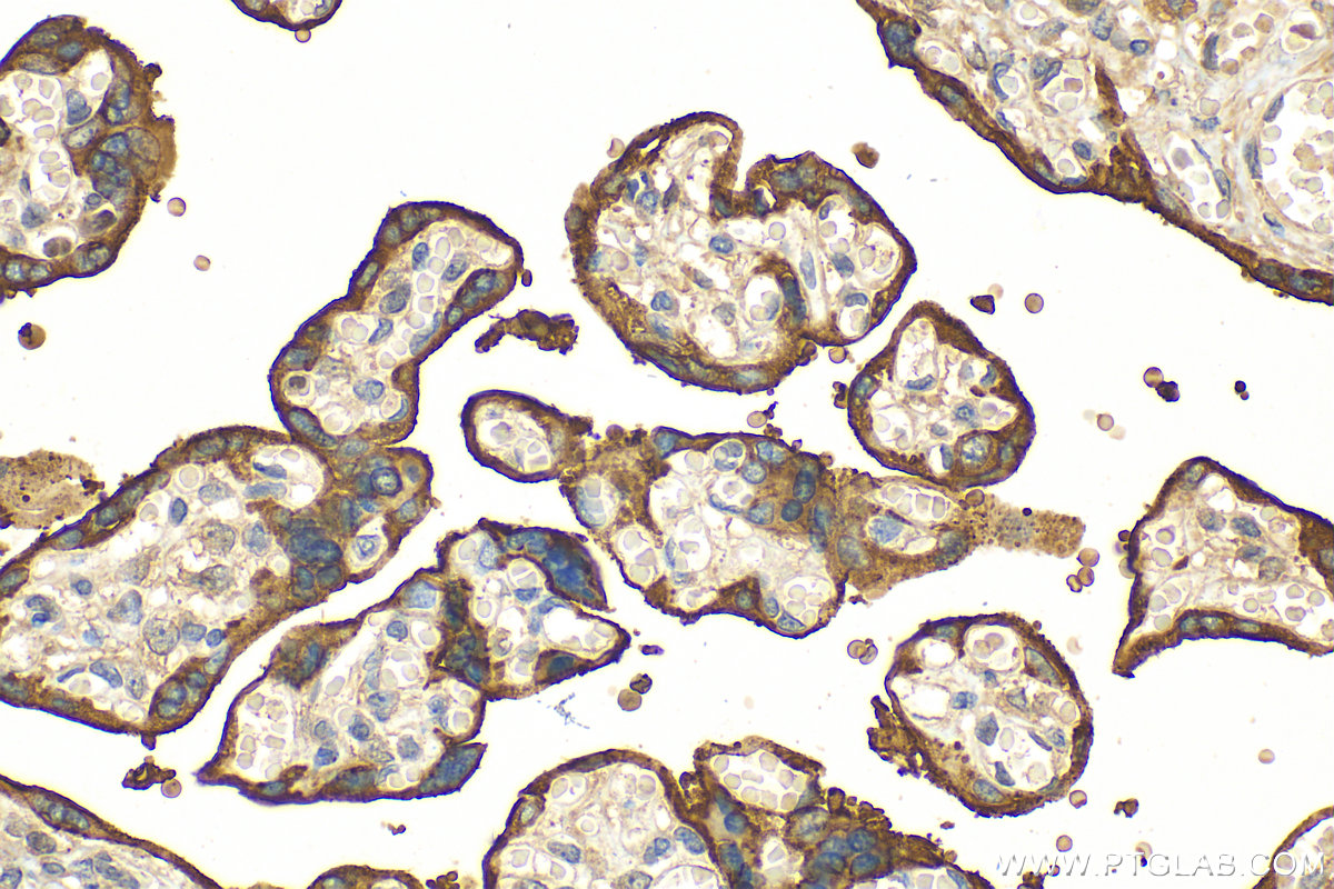 IHC staining of human placenta using 18506-1-AP