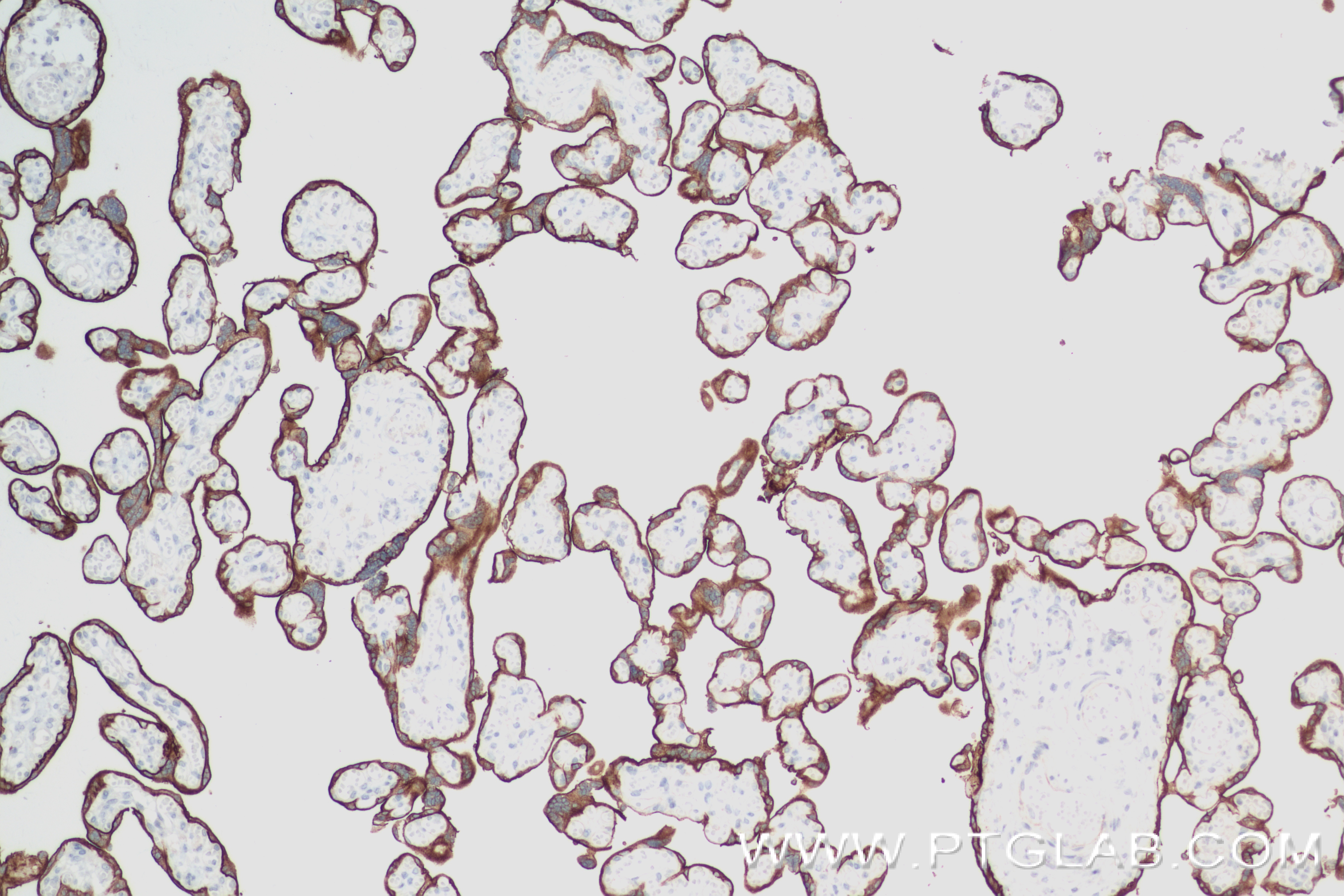 IHC staining of human placenta using 84813-1-RR (same clone as 84813-1-PBS)