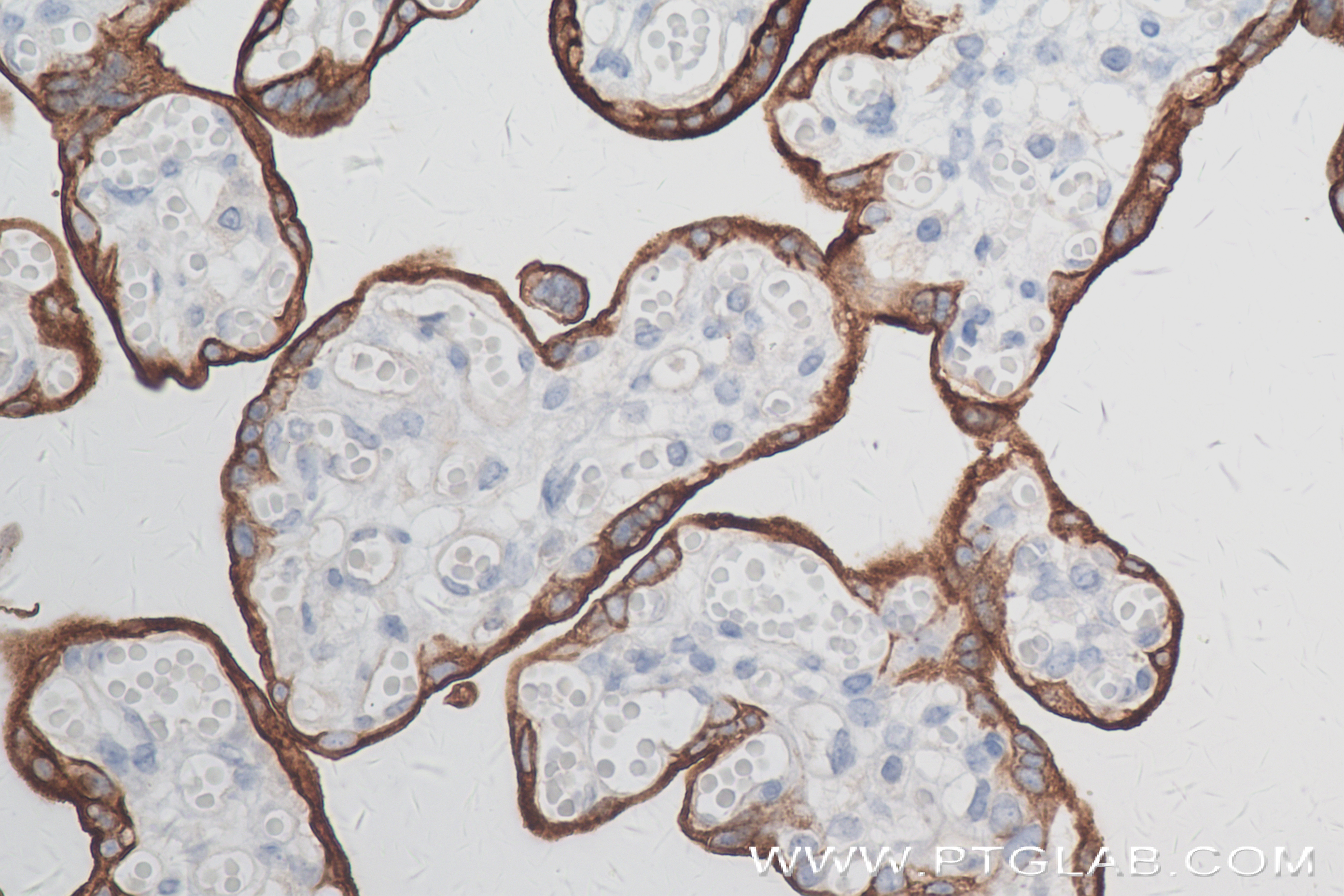 IHC staining of human placenta using 84813-1-RR (same clone as 84813-1-PBS)