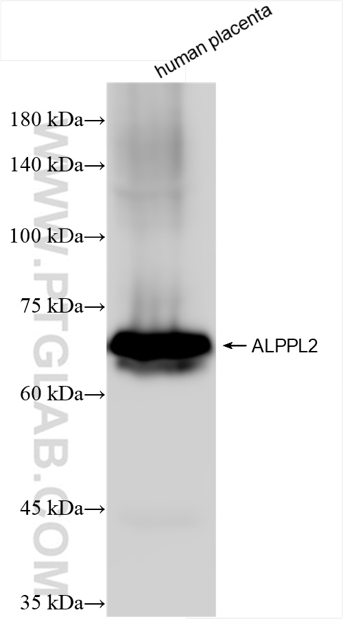 WB analysis of human placenta using 84813-1-RR