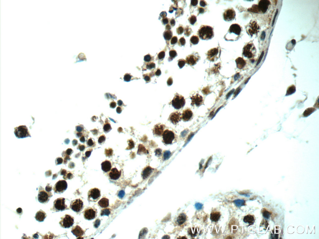 IHC staining of human testis using 13434-1-AP