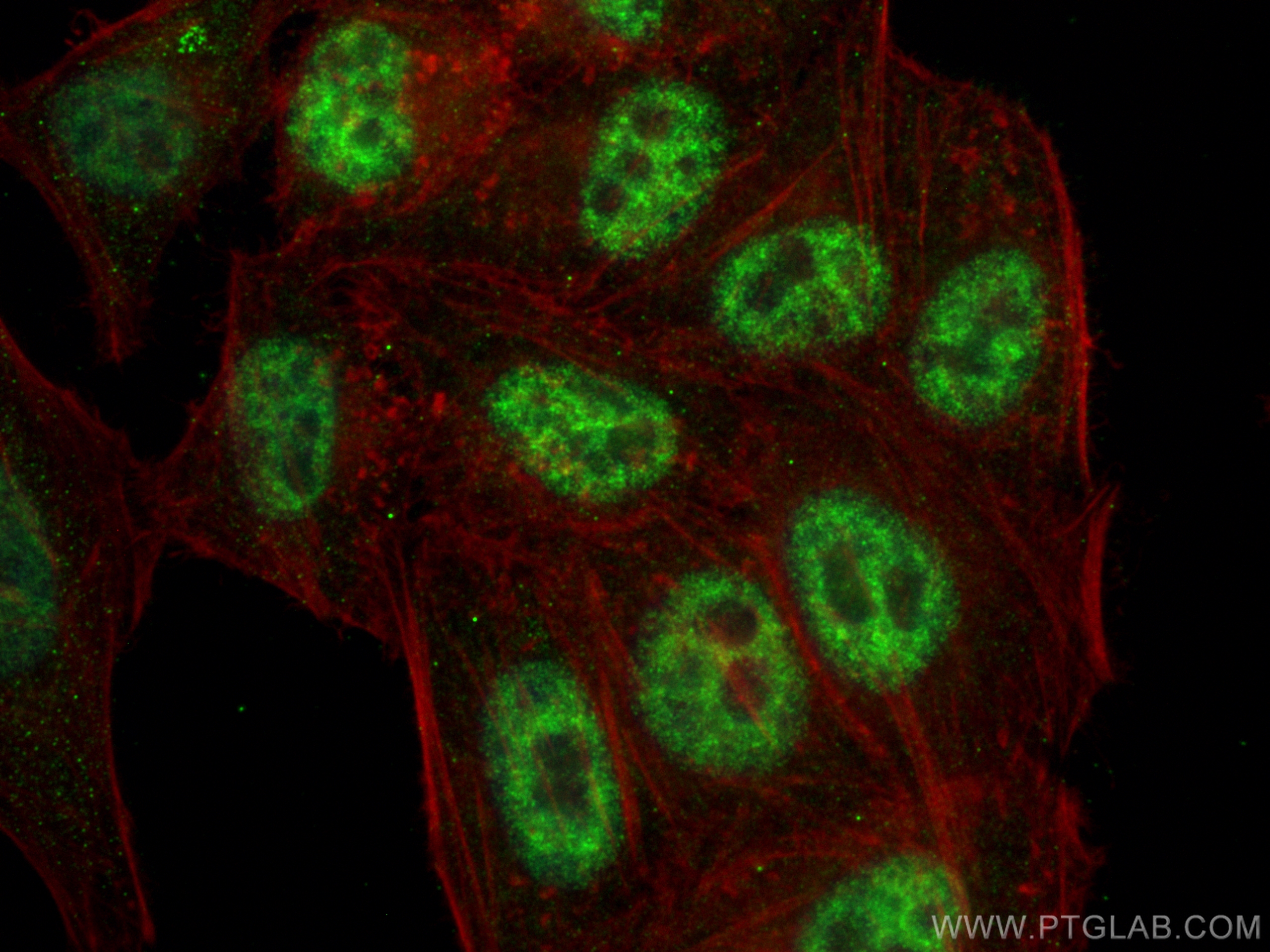 IF Staining of HepG2 using 16690-1-AP