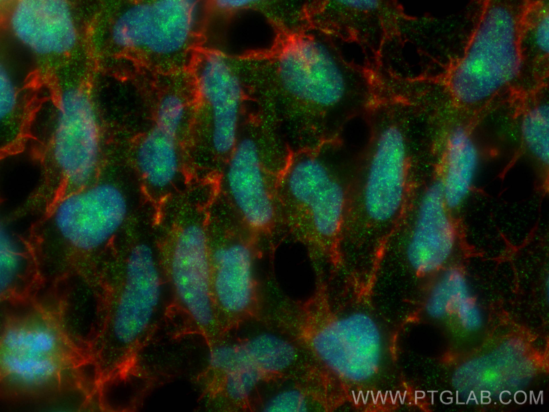 IF Staining of HEK-293 using 26501-1-AP