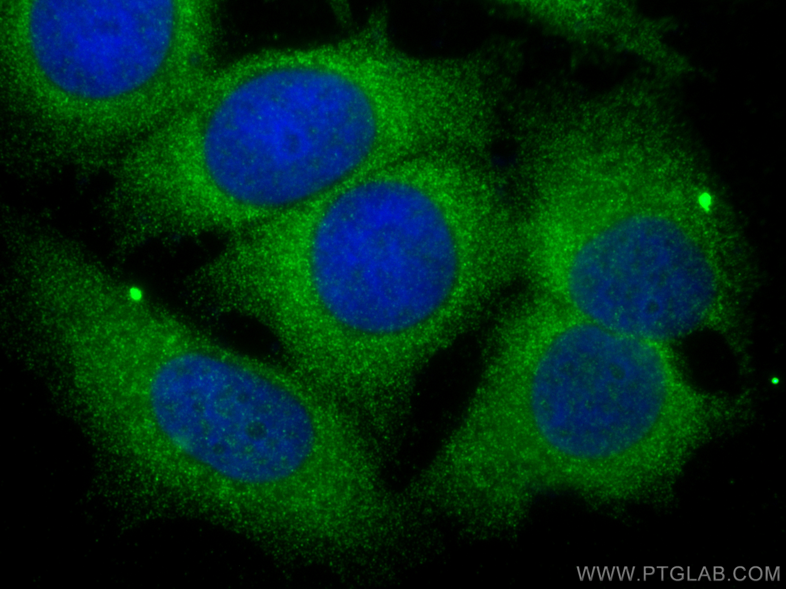 IF Staining of MCF-7 using 13762-1-AP