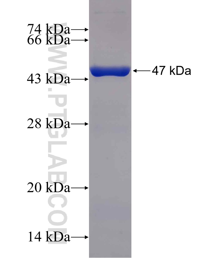 AMD1 fusion protein Ag30751 SDS-PAGE