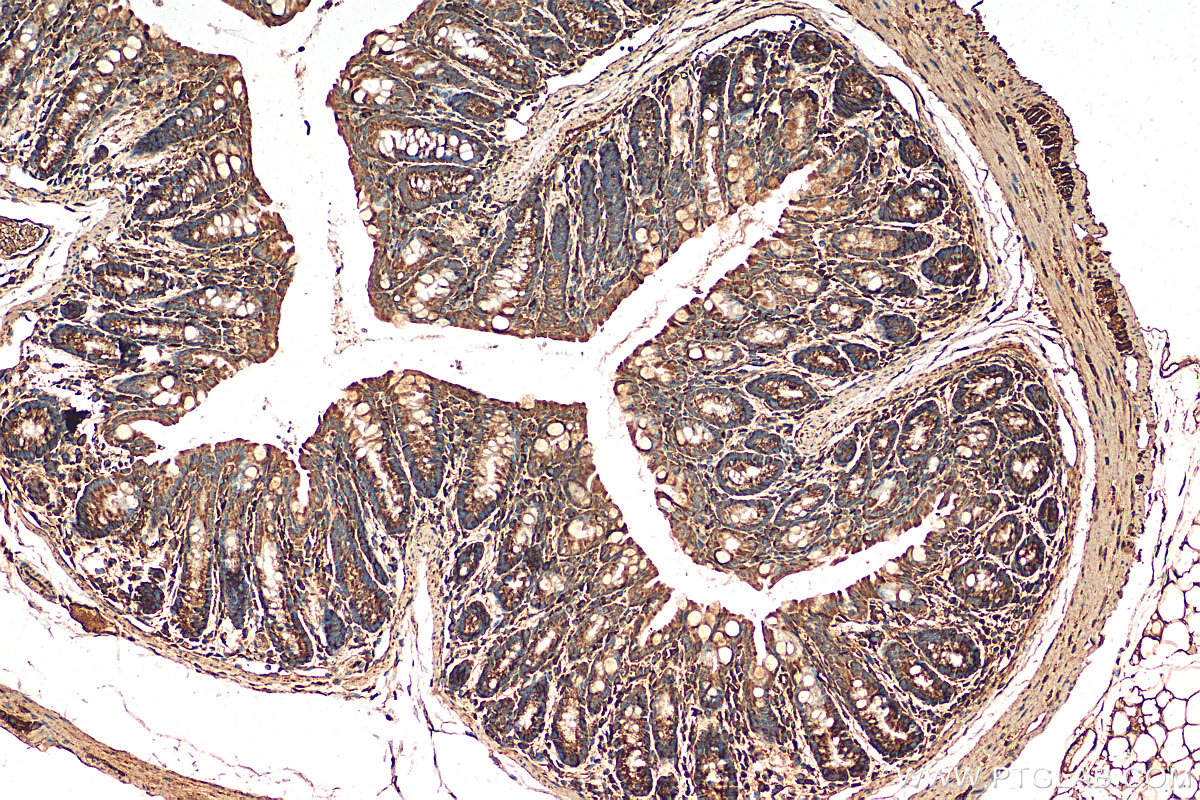 IHC staining of mouse colon using 21171-1-AP