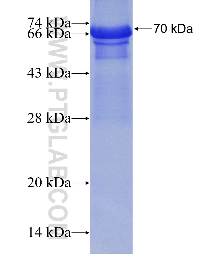 AMFR fusion protein Ag10178 SDS-PAGE