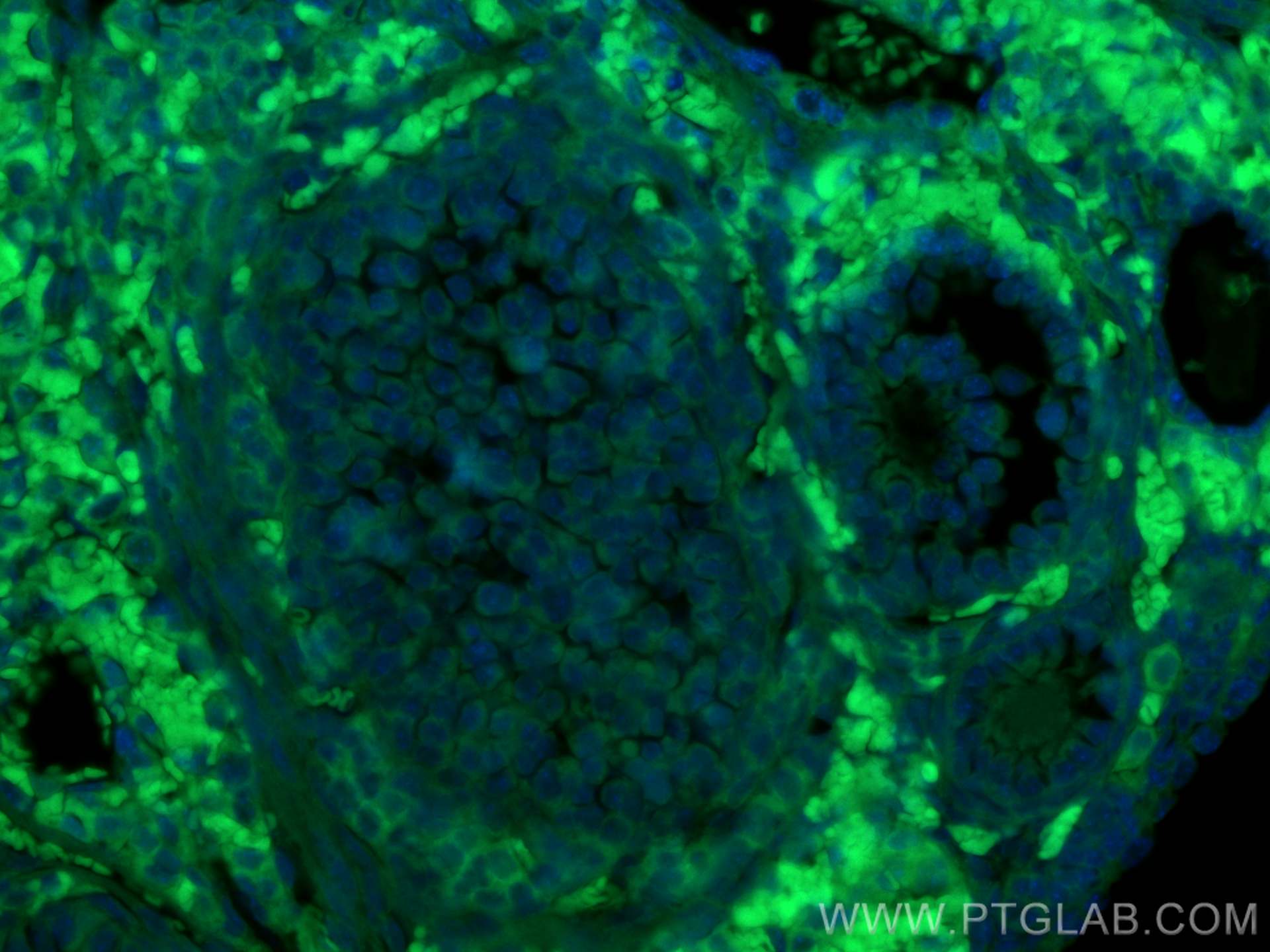 IF Staining of mouse ovary using CL488-14461