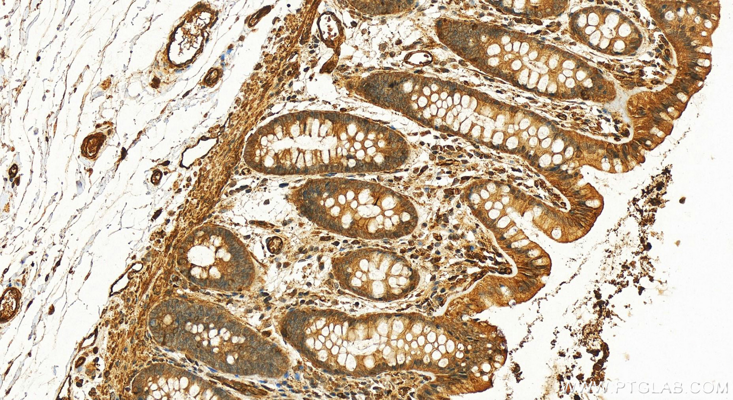 IHC staining of human colon using 23997-1-AP