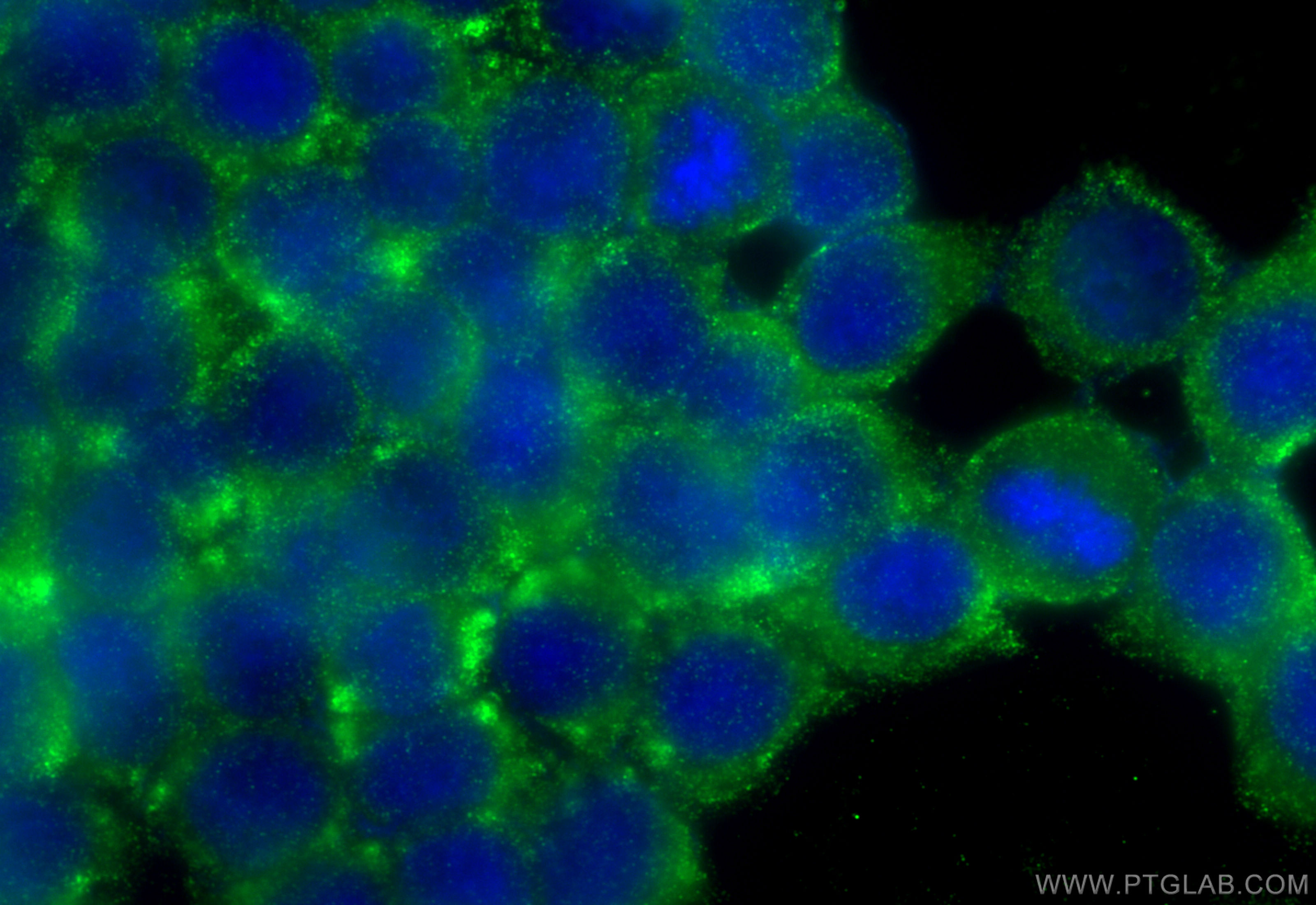 IF Staining of BxPC-3 using 66133-1-Ig