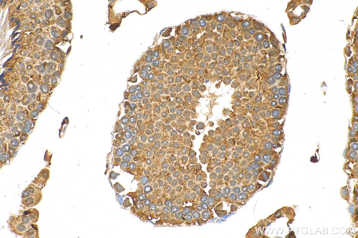 IHC staining of mouse testis using 21748-1-AP