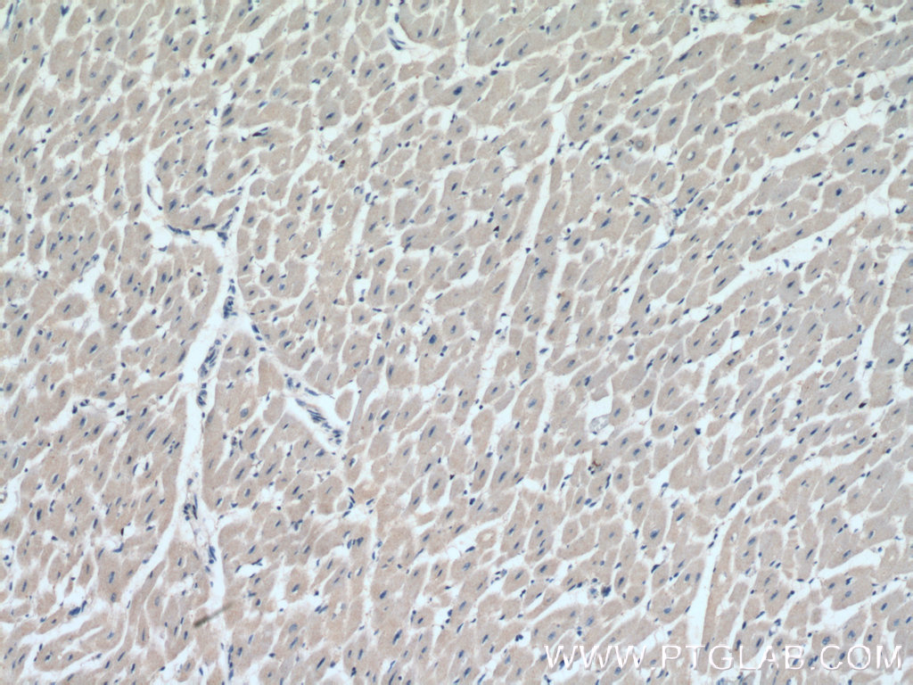 IHC staining of human heart using 15788-1-AP