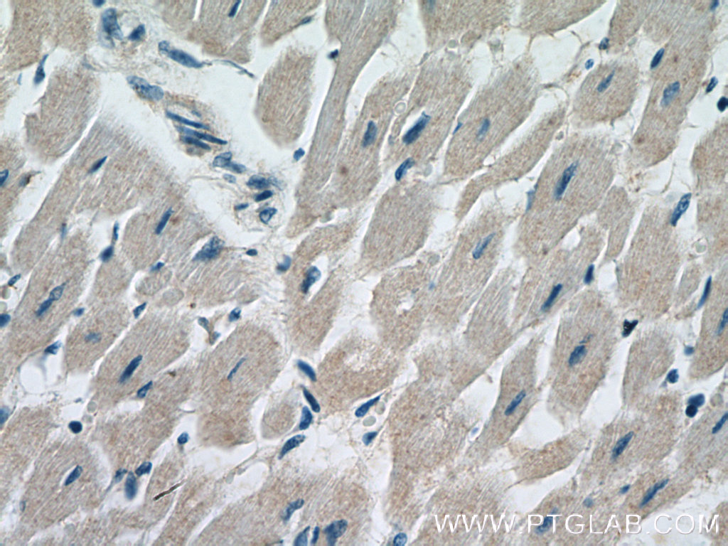 IHC staining of human heart using 15788-1-AP