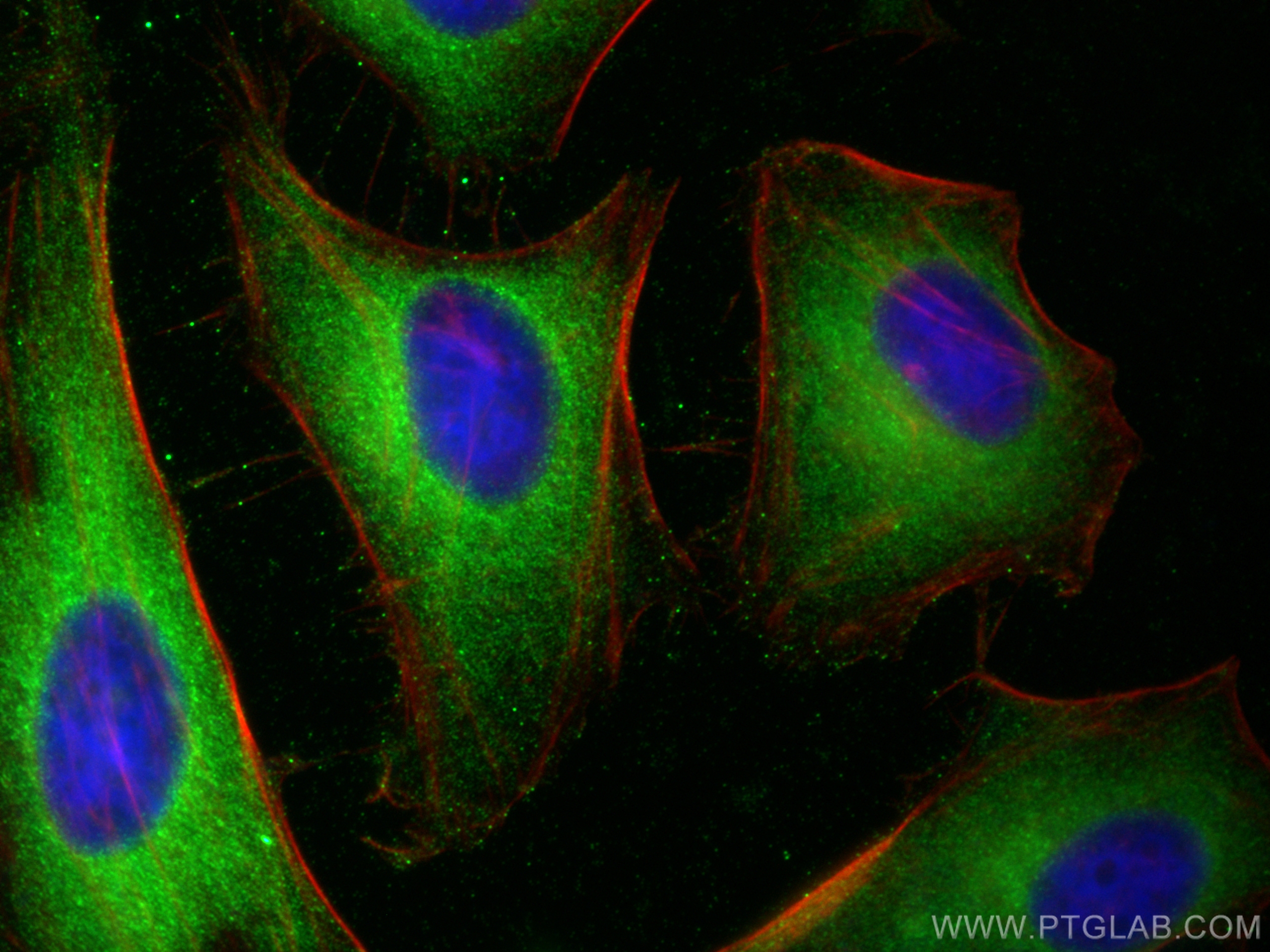 IF Staining of HeLa using 23302-1-AP