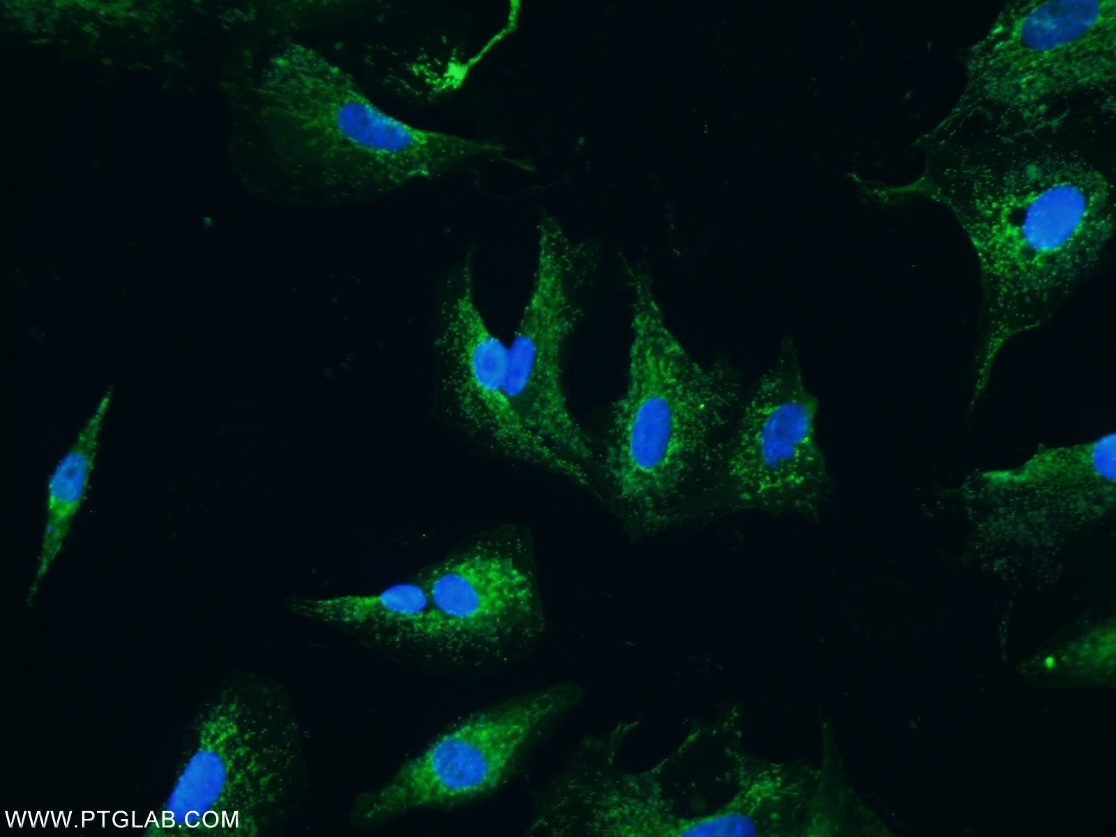 Angiopoietin 2