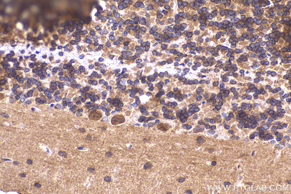 IHC staining of rat cerebellum using 23938-1-AP