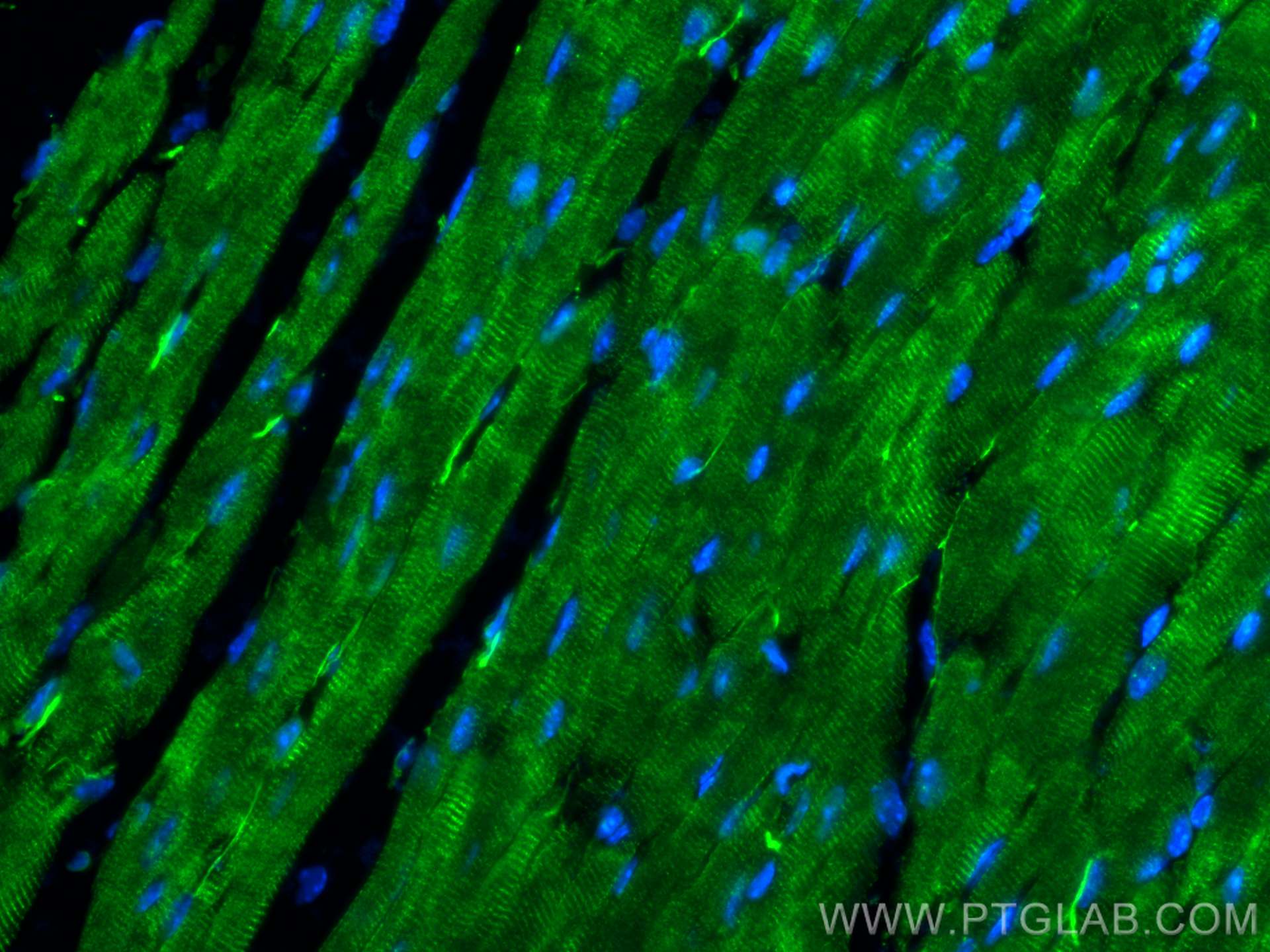 IF Staining of mouse heart using 31080-1-AP