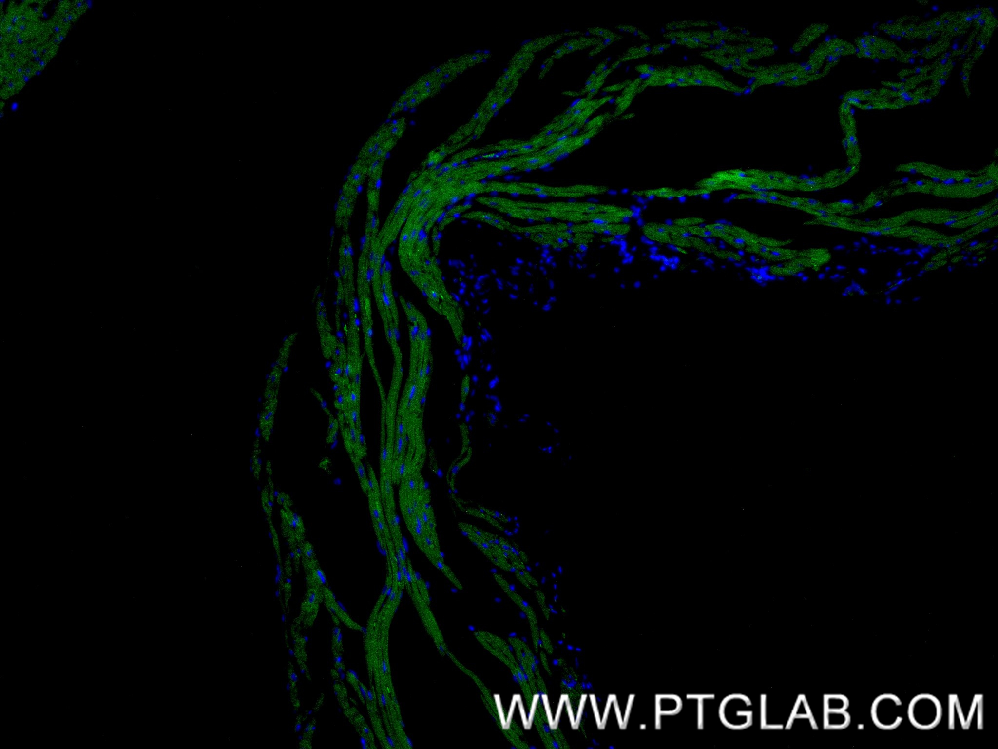 IF Staining of mouse heart using 83912-5-RR (same clone as 83912-5-PBS)