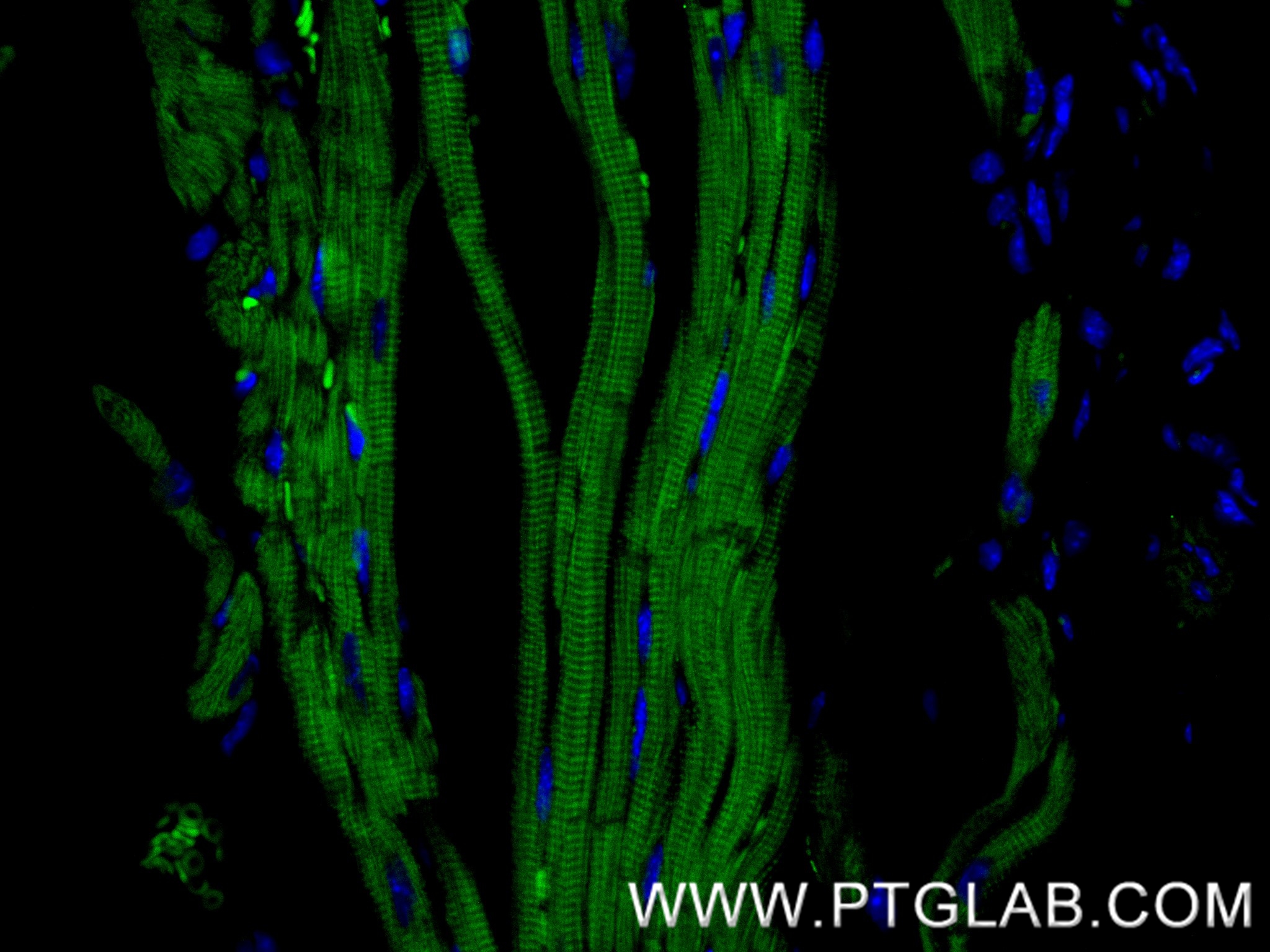 IF Staining of mouse heart using 83912-5-RR (same clone as 83912-5-PBS)