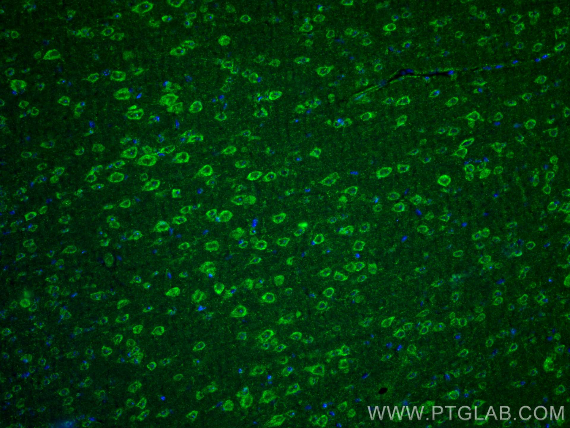 IF Staining of mouse brain using 27766-1-AP