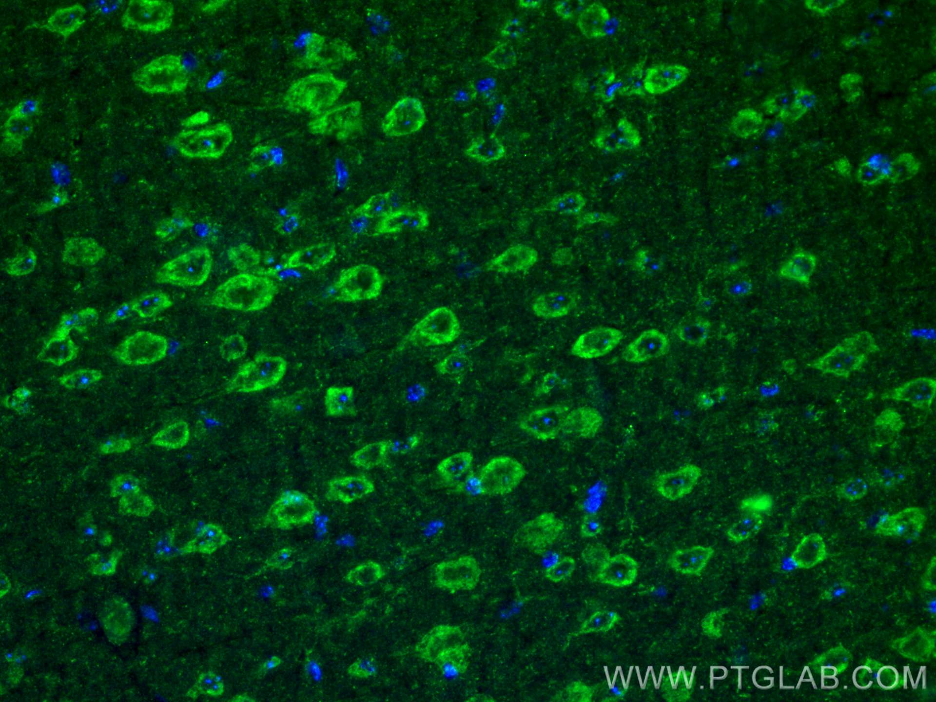 IF Staining of mouse brain using 27766-1-AP