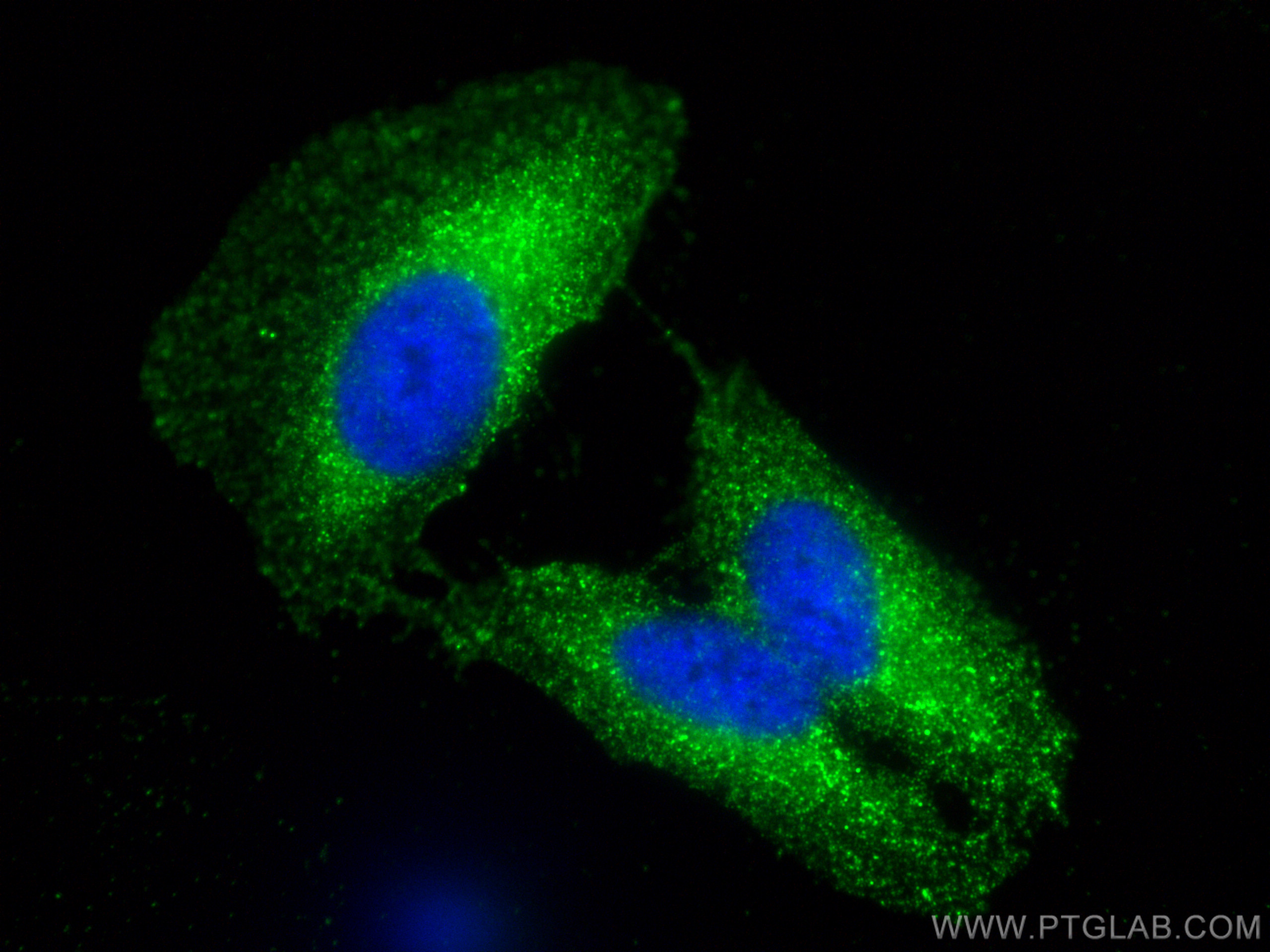 IF Staining of U2OS using 30467-1-AP