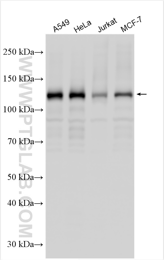 WB analysis using 30467-1-AP