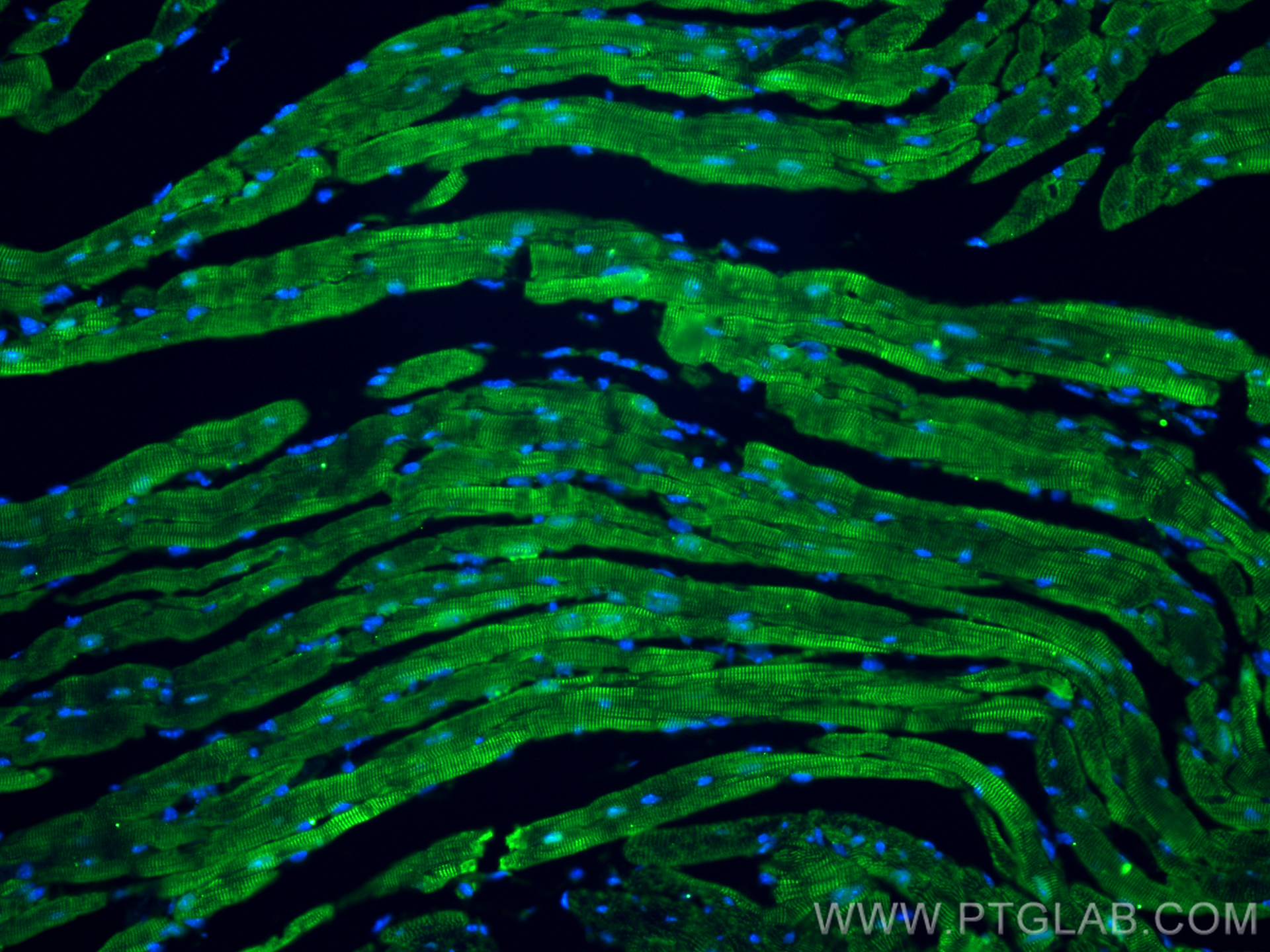 IF Staining of mouse heart using 11427-1-AP